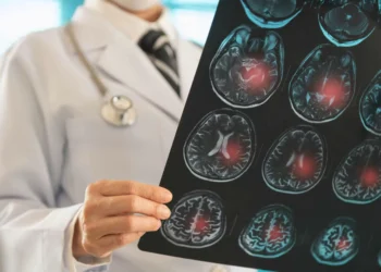 Brasil investiga fatores genéticos que influenciam risco de AVC